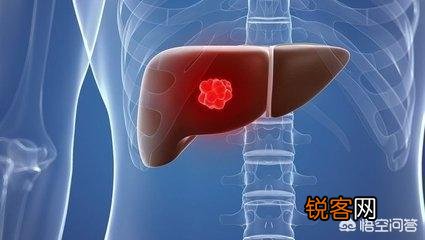 日常生活中如何预防肝癌？
