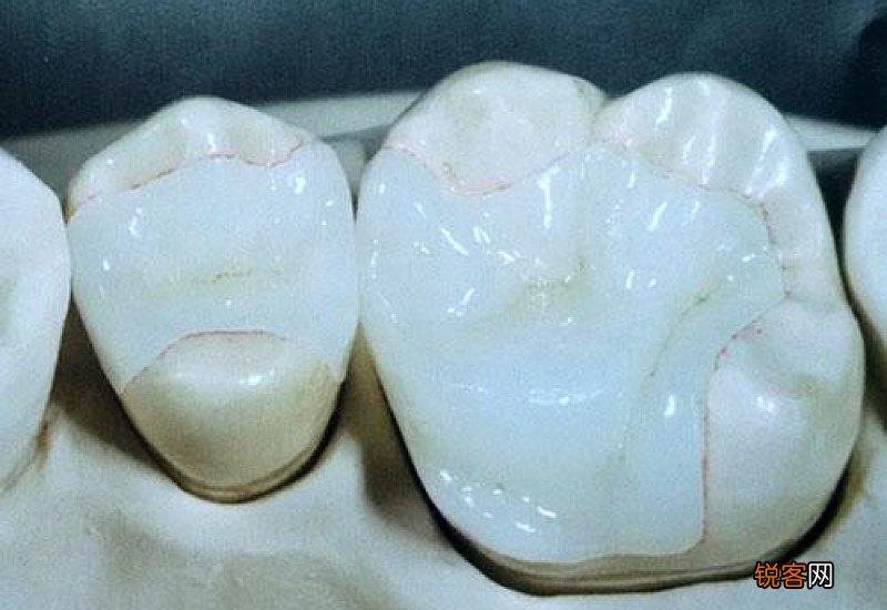 补牙可以用社保卡报销吗 报销范围是什么?