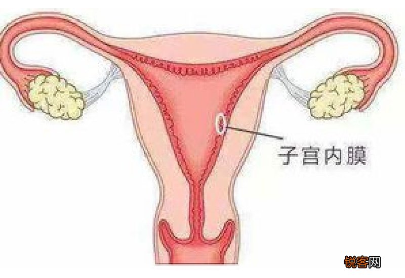 子宫内膜出血是怎么引起的 子宫内膜出血怎么治疗