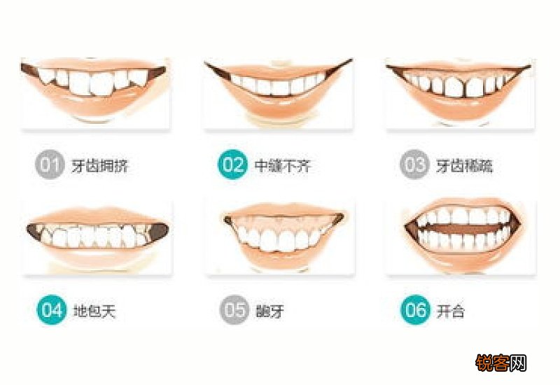 什么时候矫正牙齿最好？矫正牙齿的最佳时间