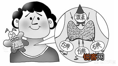 甲状腺癌的病因有哪些,如何警惕？