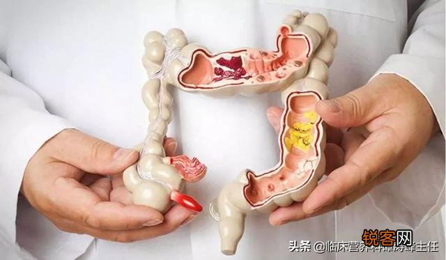 癌症患者饮食“黑名单”有哪些？