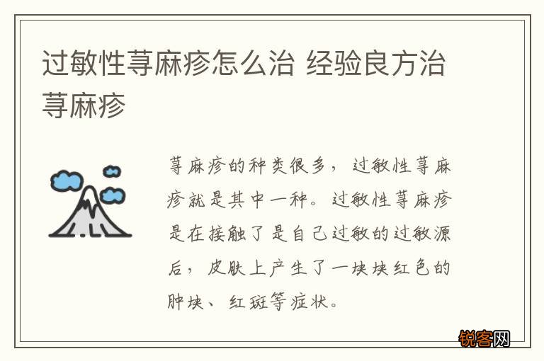 过敏性荨麻疹怎么治 经验良方治荨麻疹