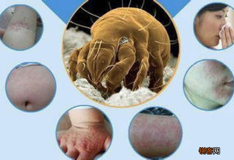 怎么让身上没有螨虫