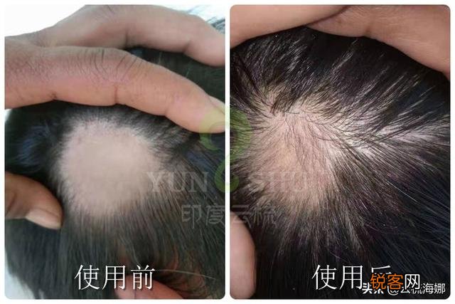 有什么有用的生发洗发水推荐吗？