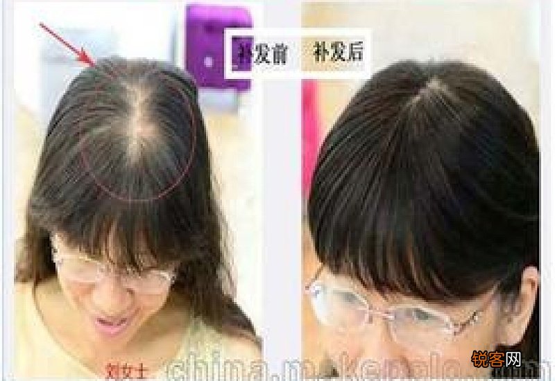 补发色的价格一般是多少钱 补发色的步骤