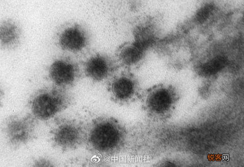 新冠病毒变异后是什么样的