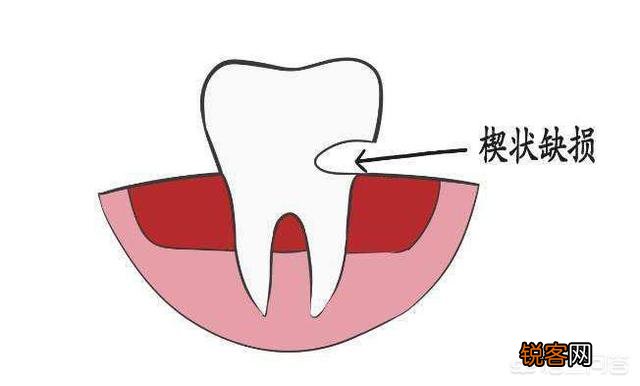 万能的头条,牙疼有什么办法快速止疼啊？