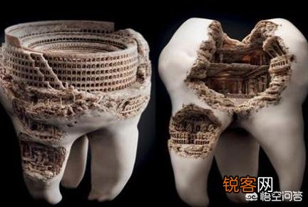 长时间牙痛怎么治？