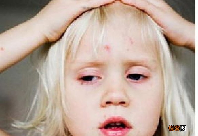 眼部肌肉抽搐怎么治疗 眼部肌肉不自觉的跳动是怎么回事