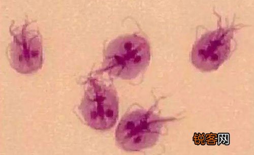 包皮龟头炎的表示有哪些？包皮龟头炎是怎样感染的？