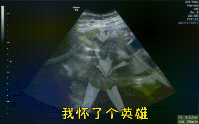 有没有搞笑奥特曼图片？