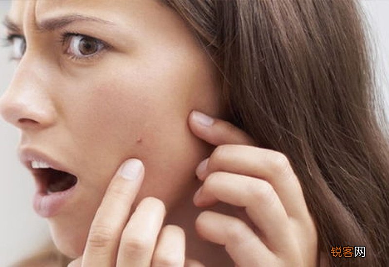 刷酸痘痘全部爆出来了怎么办