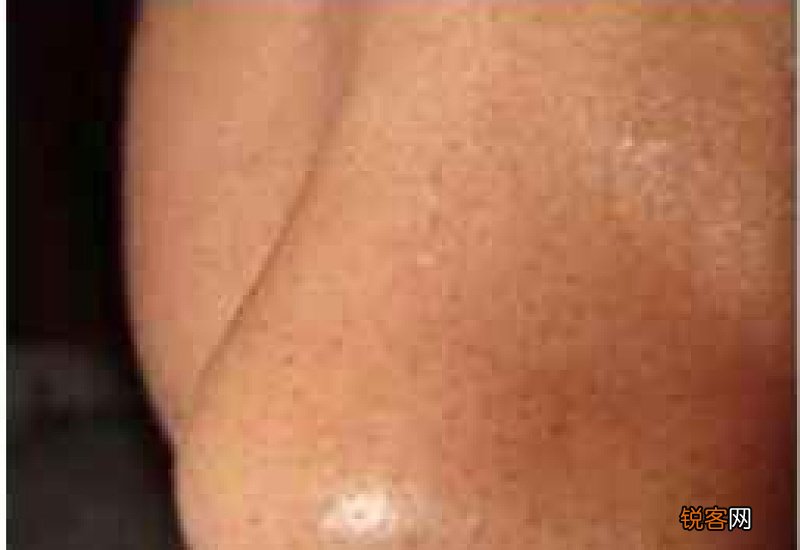 收缩毛孔去黑头护肤方法 收缩毛孔去黑头护肤方法