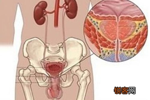 睾丸炎有什么罕见的诱因？晚期会呈现哪些症状