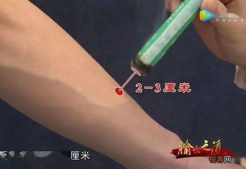 艾灸拉肚子是排毒吗