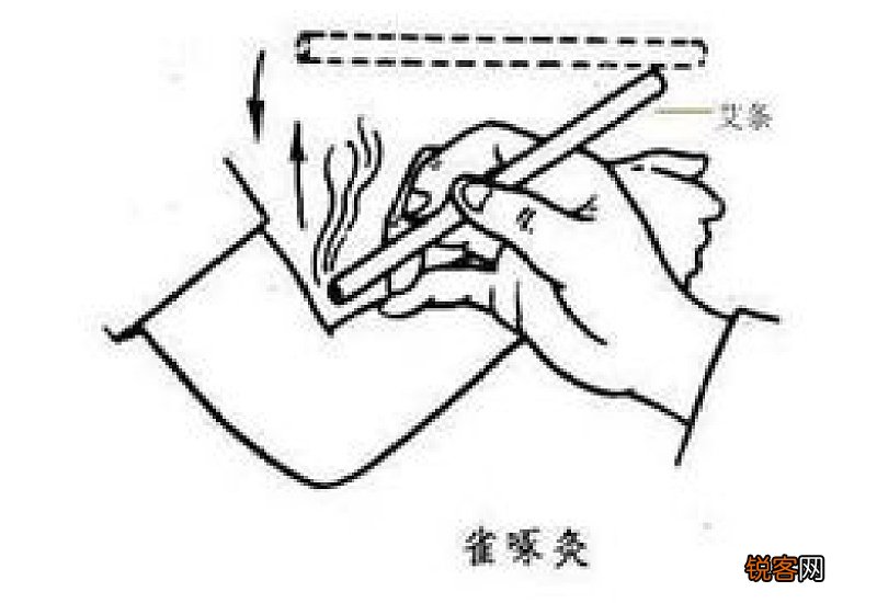 艾条烫到皮肤了怎么办