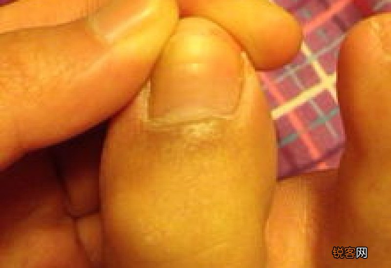 脚指甲有白色横纹怎么回事