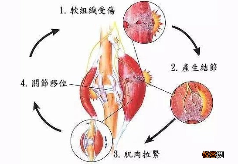 腹肌拉伤多久能恢复