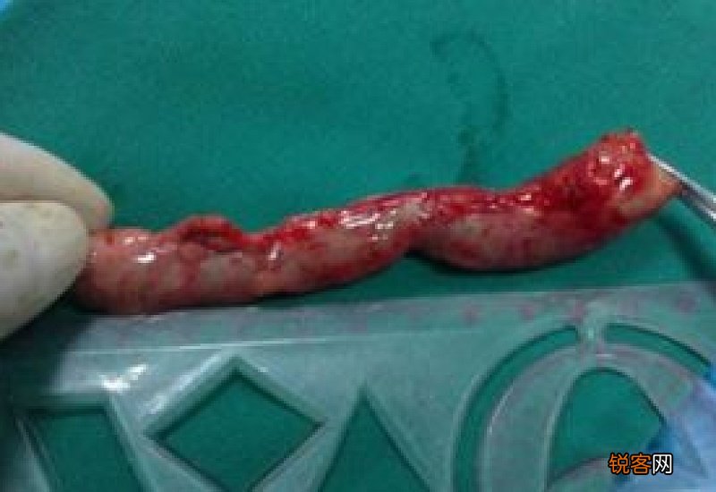 三伏天怎么去湿气啊