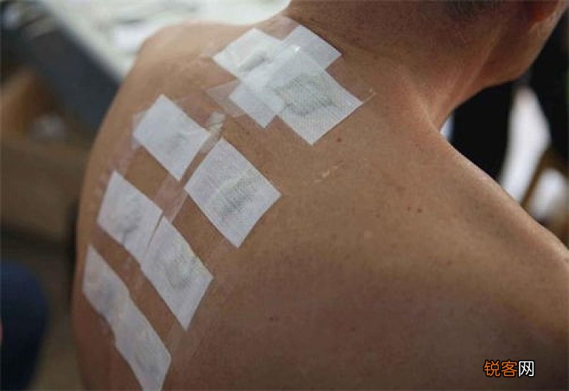 三伏贴能提高免疫力吗