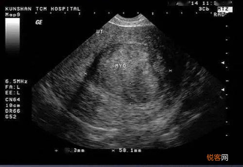 尿意不强烈可以做b超吗