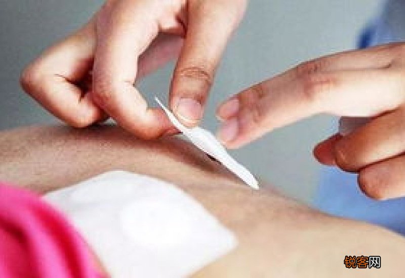 冬病夏治三伏天怎样调理身体