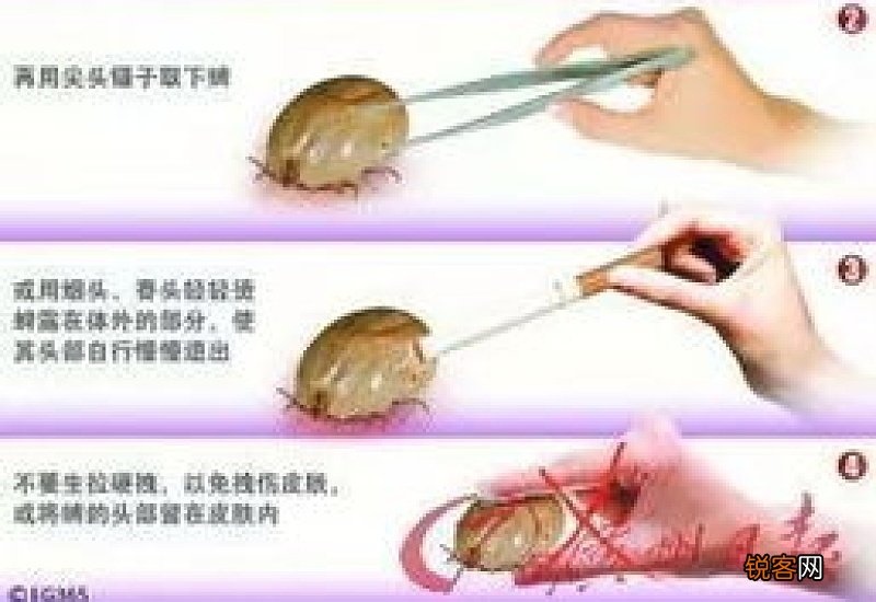 狗狗身上的蜱虫怎么去除简单方法