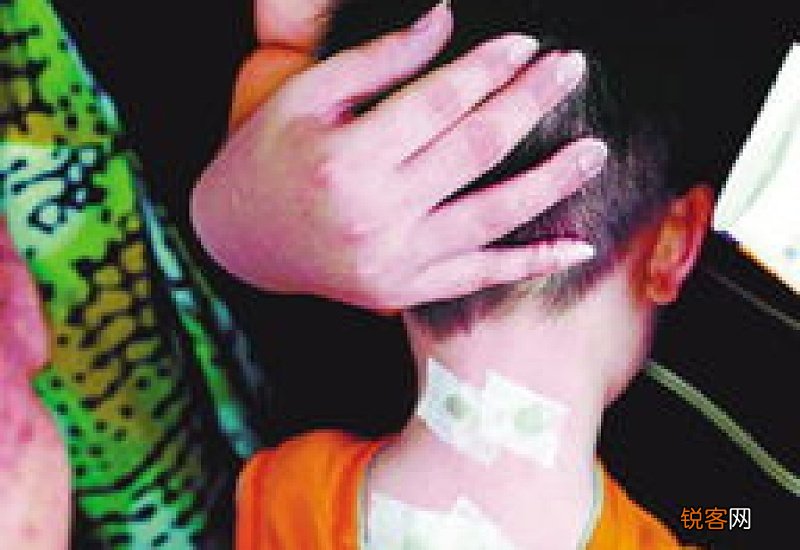 天灸主要贴哪几个位置