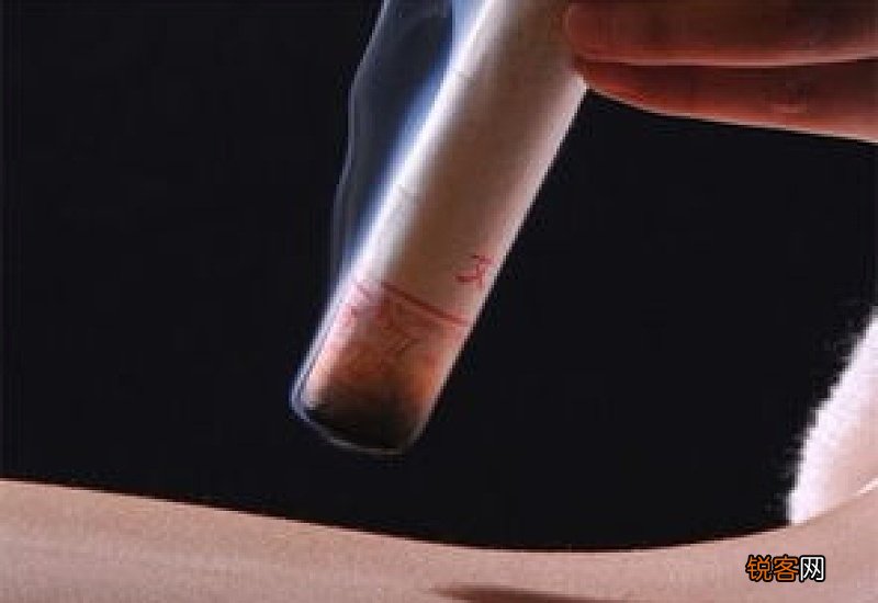 艾灸晚上可以做吗