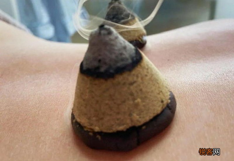 艾叶可以直接点燃灸吗