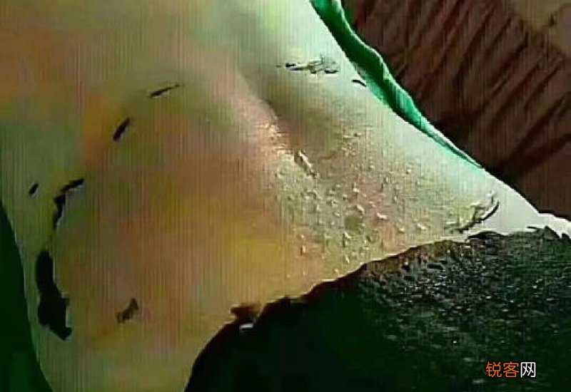 敷泥灸为什么又热又痒