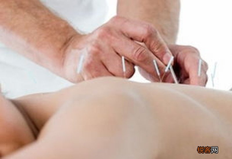 针灸什么时间效果最佳