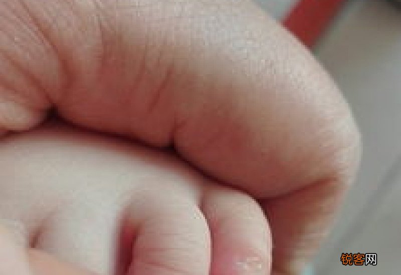 为什么小脚趾甲是一坨