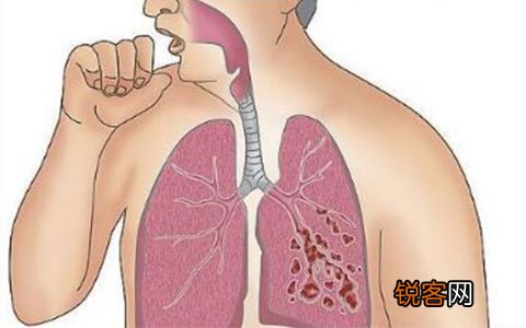 喘息性支气管炎与支气管哮喘有什么区别？