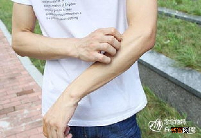 为什么会突然得了荨麻疹
