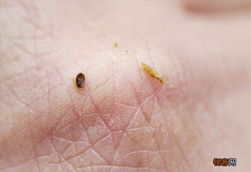 螨虫是怎么产生的