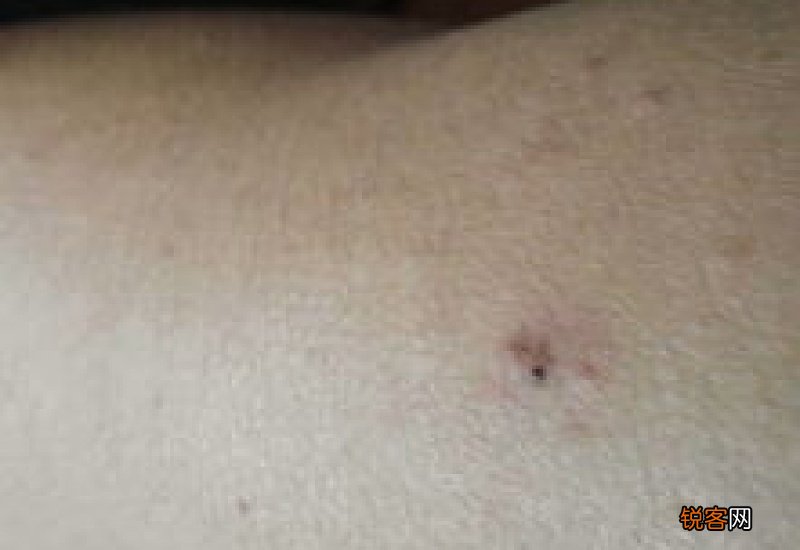 如何快速去手上的墨水