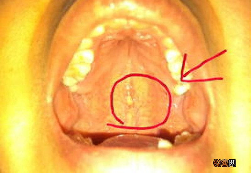 一次性医用口罩的检验方法