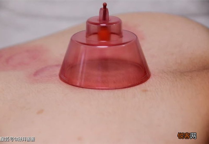 走罐可以天天做么