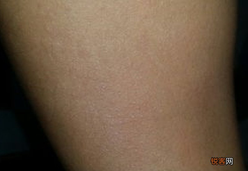 为什么冬天有头屑夏天就没了