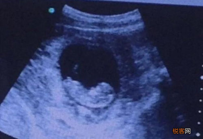 怀孕了可以打九价吗