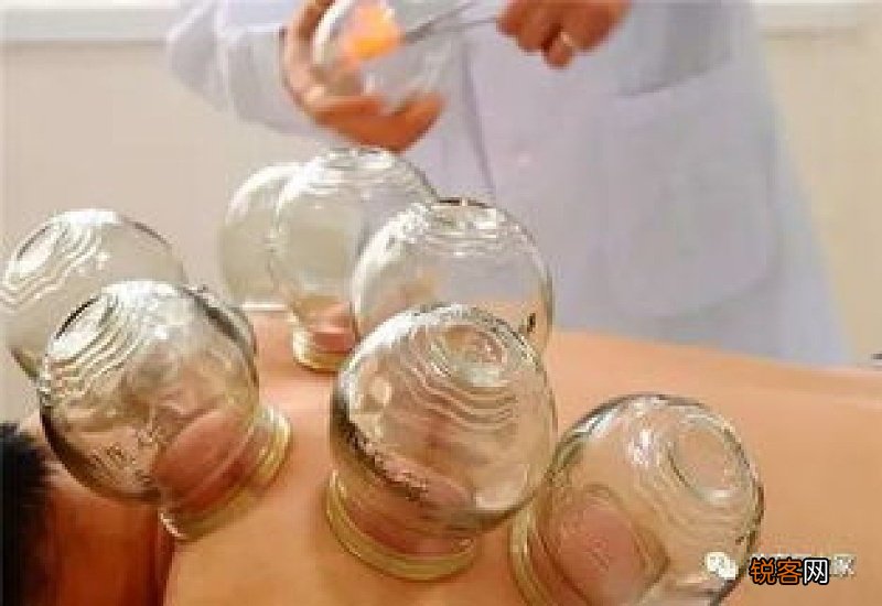 嘴巴上火拔罐有用吗