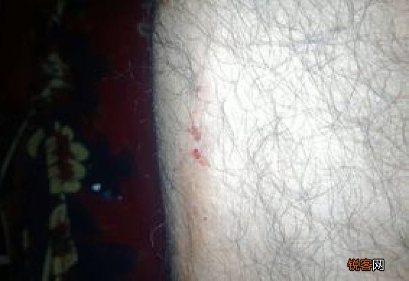 金毛皮肤病会不会传染人