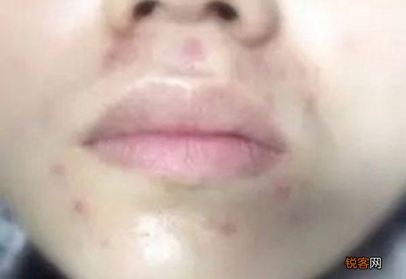 怎么去肝火效果好