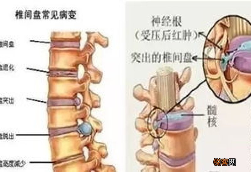 腰椎贴能贴颈椎吗