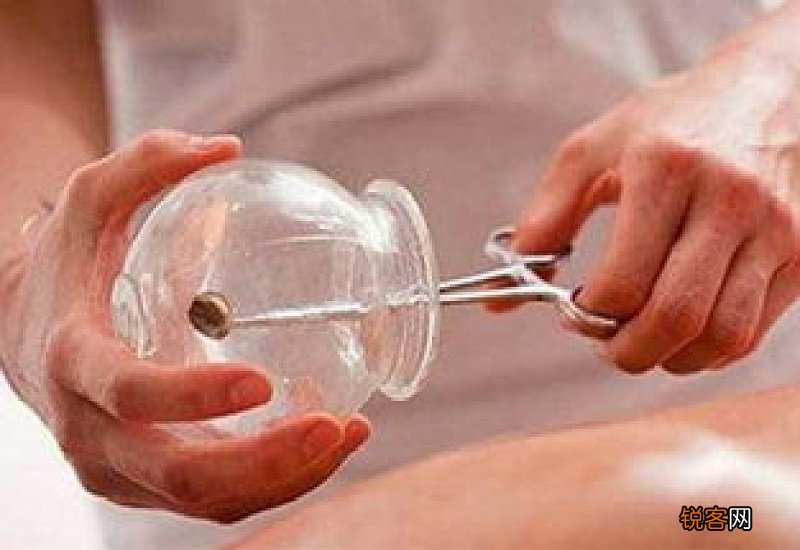 拔罐腰部黑紫肾虚吗