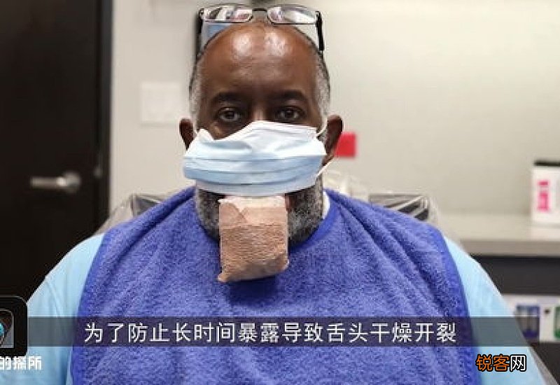 新冠患者治愈后有哪些后遗症